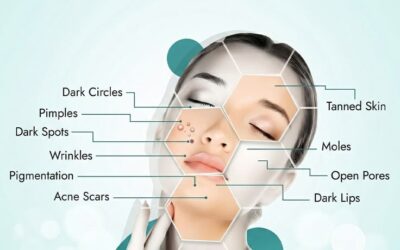 How Dr. Titoria’s Clinics Treats Acne, Pigmentation, and Skin Disorders